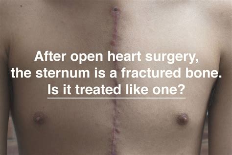 The Miracle of a New Life: How to Heal Your Sternum After Heart Surgery